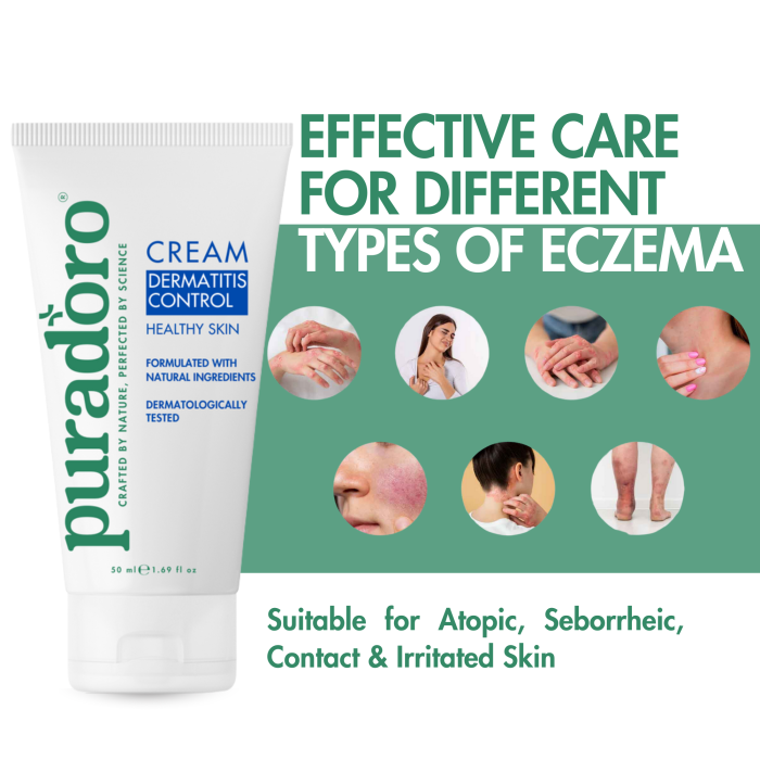 Creme para Dermatite & Pele Saudável – Alivia a comichão, vermelhidão e descamação 50ml - Image 5